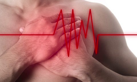 5 preguntas que siempre te has hecho sobre el infarto